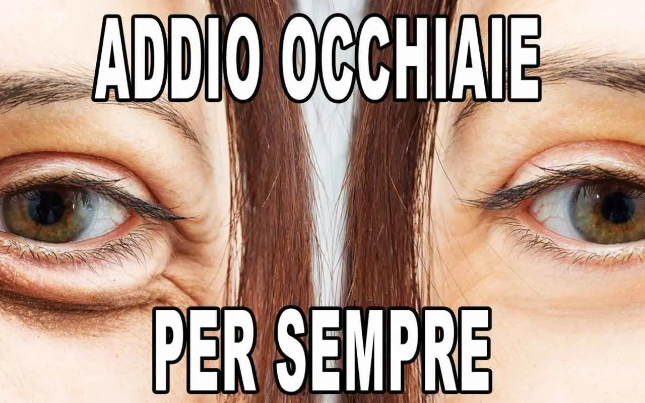 Come curare un orzaiolo all’occhio velocemente? Il rimedio della nonna che lo fa sgonfiare